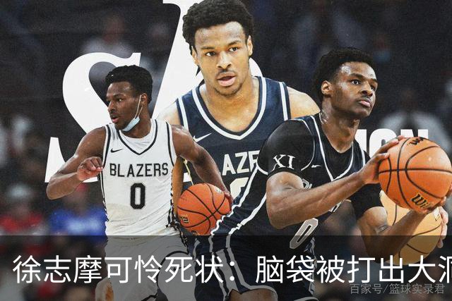 徐志摩可怜死状：脑袋被打出大洞，四肢被烈火炙烤成焦炭！
